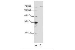 Image no. 1 for anti-Interleukin-1 Receptor-Associated Kinase 3 (IRAK3) (AA 441-490) antibody (ABIN6736196) (IRAK3 antibody  (AA 441-490))