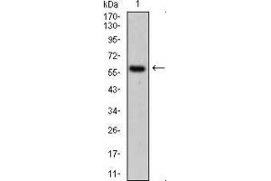 Western blot analysis using CK5 mouse mAb against A431 cell lysate. (Cytokeratin 5 antibody  (AA 316-590))