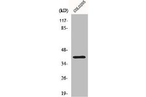 Western Blot analysis of COLO205 cells using Dok-6 Polyclonal Antibody (DOK6 antibody  (Internal Region))