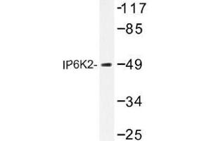 Image no. 1 for anti-Inositol Hexakisphosphate Kinase 2 (IP6K2) antibody (ABIN317720) (IP6K2 antibody)