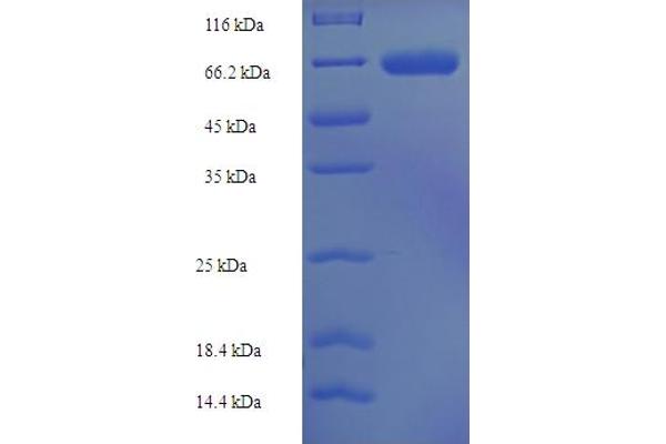 PRDM16 Protein (AA 19-471) (His-SUMO Tag)