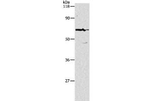Western Blot analysis of Hela cell using PKM Polyclonal Antibody at dilution of 1:500 (PKM antibody)