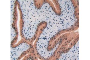 IHC-P analysis of Mouse Testis Tissue, with DAB staining. (CS antibody  (AA 174-428))