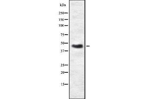 Western blot analysis of PRKAR2B using A549 whole  lysates. (PRKAR2B antibody  (Internal Region))