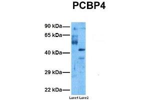 Host:  Rabbit  Target Name:  PCBP4  Sample Tissue:  Human Ovary Tumor, Human 293T  Antibody Dilution:  1. (PCBP4 antibody  (C-Term))