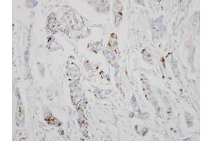 IHC-P Image Immunohistochemical analysis of paraffin-embedded HBL435 xenograft, using GALNT6, antibody at 1:500 dilution. (GALNT6 antibody)