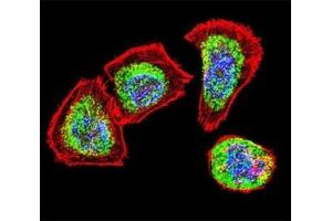 Confocal immunofluorescent analysis of Vimentin antibody with U251 cells followed by Alexa Fluor 488-conjugated goat anti-rabbit lgG (green). (Vimentin antibody)