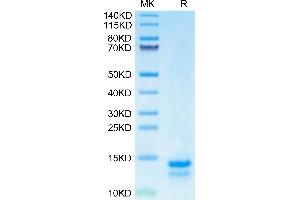 Human FAM19A5 on Tris-Bis PAGE under reduced condition. (FAM19A5 Protein (AA 37-125) (His tag))