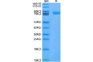 Human uPAR on Tris-Bis PAGE under reduced condition. (PLAUR Protein (AA 23-305) (Fc Tag))