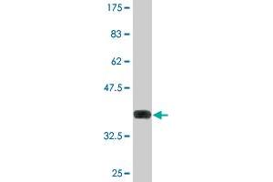 Western Blotting (WB) image for anti-Patatin-Like phospholipase Domain Containing 6 (PNPLA6) (AA 1229-1327) antibody (ABIN524312)