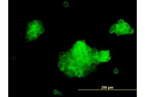 Immunofluorescence of monoclonal antibody to STX5A on A-431 cell. (Syntaxin 5 antibody  (AA 1-100))