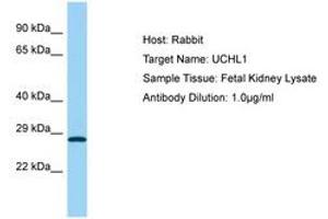 Image no. 1 for anti-Ubiquitin Carboxyl-terminal Esterase L1 (Ubiquitin Thiolesterase) (UCHL1) (AA 98-147) antibody (ABIN6749946) (UCHL1 antibody  (AA 98-147))