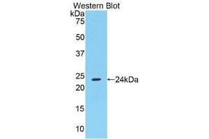 Western Blotting (WB) image for anti-Fibrinogen alpha Chain (FGA) (AA 357-556) antibody (ABIN1174272) (FGA antibody  (AA 357-556))