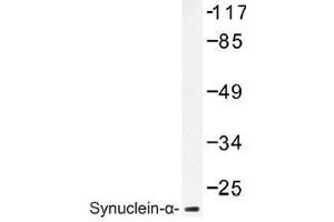 Image no. 1 for anti-Synuclein, alpha (SNCA) antibody (ABIN317944) (SNCA antibody)