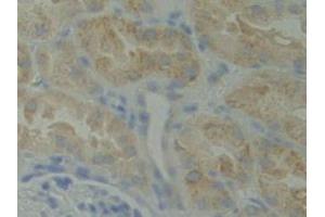 Detection of BMX in Human Kidney Tissue using Polyclonal Antibody to BMX Non Receptor Tyrosine Kinase (BMX) (BMX antibody  (AA 287-523))
