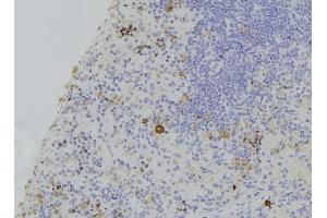ABIN6273119 at 1/100 staining Human lymph node tissue by IHC-P. (GSDMD antibody)