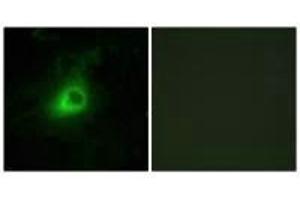 Immunofluorescence analysis of HeLa cells, using GRK6 antibody. (GRK6 antibody  (N-Term))