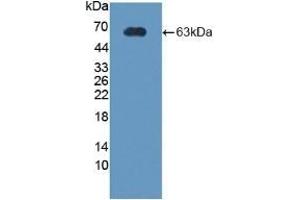 Detection of Recombinant CRHBP, Rat using Polyclonal Antibody to Corticotropin Releasing Hormone Binding Protein (CRHBP) (CRHBP antibody  (AA 25-322))