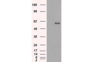HEK293T cells were transfected with the pCMV6-ENTRY control (Left lane) or pCMV6-ENTRY KRT8 (Right lane) cDNA for 48 hrs and lysed. (KRT8 antibody  (AA 91-381))