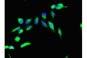 Immunofluorescent analysis of Hela cells using ABIN7168184 at dilution of 1:100 and Alexa Fluor 488-congugated AffiniPure Goat Anti-Rabbit IgG(H+L) (MSK2 antibody  (AA 237-393))