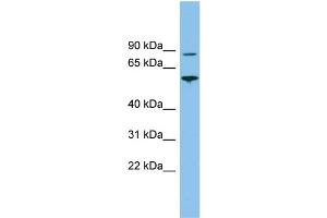 WB Suggested Anti-VPS52 Antibody Titration: 0. (VPS52 antibody  (Middle Region))