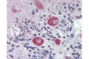 Immunohistochemistry (IHC) image for anti-Grainyhead-Like 2 (GRHL2) (Middle Region) antibody (ABIN2778358)