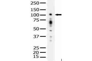 Image no. 1 for anti-Protein Kinase D1 (PRKD1) antibody (ABIN272066) (PKC mu antibody)
