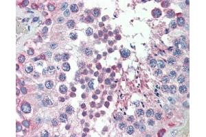 MED4 antibody was used for immunohistochemistry at a concentration of 4-8 ug/ml. (MED4 antibody  (C-Term))