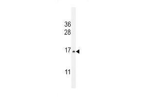 Western blot analysis in HepG2 cell line lysates (35ug/lane). (CST9 antibody  (C-Term))