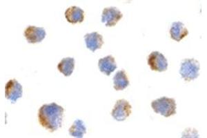 Image no. 2 for anti-Nerve Growth Factor Receptor (NGFR) antibody (ABIN318704) (NGFR antibody)