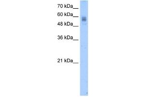 Protein C antibody used at 2. (PROC antibody)