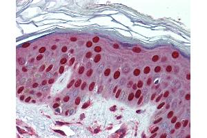 Immunohistochemistry (IHC) image for anti-Nucleolin (NCL) (N-Term) antibody (ABIN2778935)
