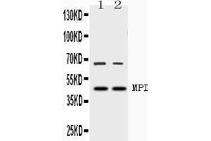 Western blot analysis of MPI expression in rat testis extract ( Lane 1) and HELA whole cell lysates ( Lane 2). (MPI antibody  (AA 2-99))