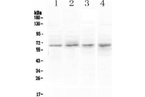 Western blot analysis of CCKBR using anti-CCKBR antibody . (CCKBR antibody)