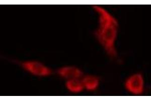 ABIN6274154 staining 293 cells by IF/ICC. (HNRNPC antibody  (C-Term))