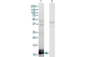 Western Blot analysis of TIAF1 expression in transfected 293T cell line by TIAF1 monoclonal antibody (M04), clone 3B9. (TIAF1 antibody  (AA 1-115))