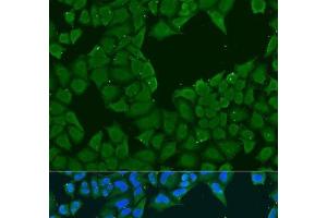 Immunofluorescence analysis of U2OS cells using MAGEA6 Polyclonal Antibody at dilution of 1:100. (MAGEA6 antibody)