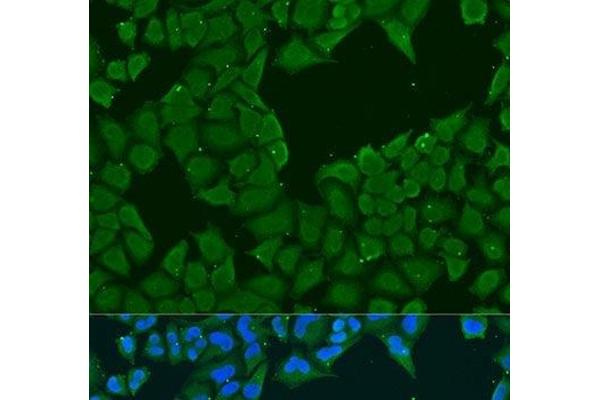 MAGEA6 antibody