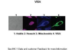 Researcher: Dr. (MAVS antibody  (N-Term))