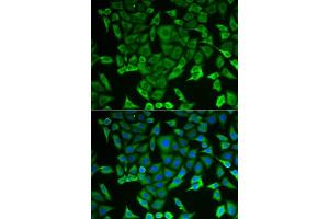 Immunofluorescence analysis of MCF-7 cells using RARS antibody (ABIN5973728). (RARS antibody)