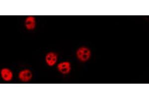 anti-PPP1CA + 1CB antibody