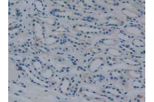 DAB staining on IHC-P; Samples: Human Kidney Tissue. (Fibrinogen beta Chain antibody  (AA 45-491))