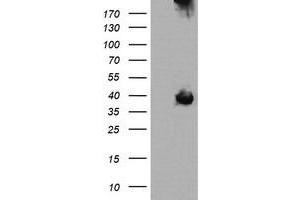 Image no. 4 for anti-Mitogen-Activated Protein Kinase Kinase 3 (MAP2K3) antibody (ABIN1499398) (MAP2K3 antibody)