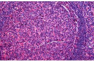 Human Tonsil: Formalin-Fixed, Paraffin-Embedded (FFPE) (CD48 antibody  (AA 1-170))