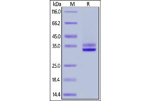 Mouse HMGB1, His Tag on  under reducing (R) condition. (HMGB1 Protein (AA 1-215) (His tag))