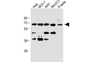 All lanes : Anti-CDC25A at 1:1000 dilution Lane 1: Hela whole cell lysate Lane 2: MCF-7 whole cell lysate Lane 3: A431 whole cell lysate Lane 4: NIH/3T3 whole cell lysate Lane 5: Rat testis lysate Lysates/proteins at 20 μg per lane. (CDC25A antibody  (Ser124))