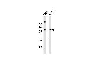 Western blot analysis of lysates from Hela cell line, rat liver tissue lysate(from left to right), using NFIA Antibody (C-term) (ABIN6242497 and ABIN6577766). (NFIA antibody  (C-Term))