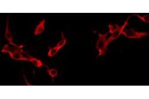 ABIN6275882 staining HuvEc by IF/ICC. (IL-21 antibody  (Internal Region))