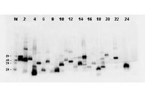 Western Blotting (WB) image for anti-DYKDDDDK Tag antibody (ABIN400788) (DYKDDDDK Tag antibody)