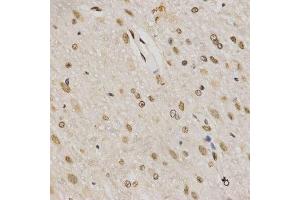 Immunohistochemistry of paraffin-embedded rat brain using TriMethyl-Histone H3-K79 antibody. (Histone 3 antibody  (H3K79me3))